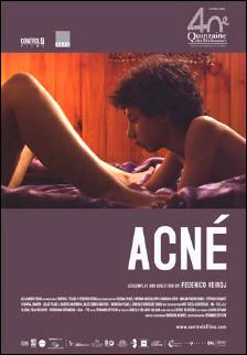 Acné (DVDRip)(Latino)